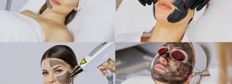 What is a Carbon Laser Facial?